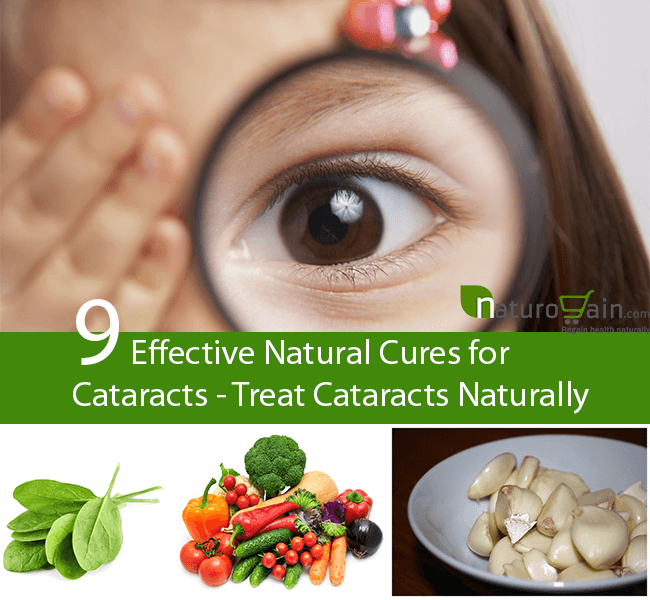 Home Remedies For Cataracts Effective Natural Cures Home Remedies For Cataracts Effective Natural Cures