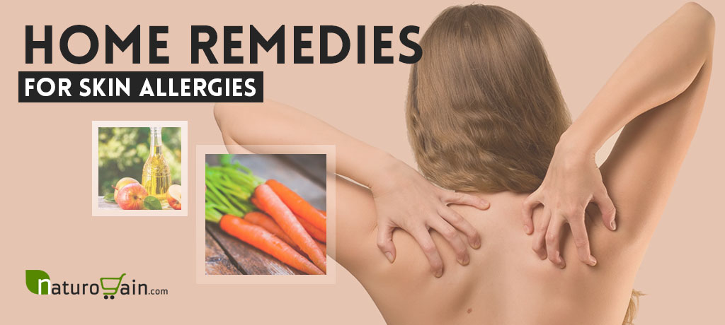 Home Remedies For Skin Allergies To Get Immediate Relief