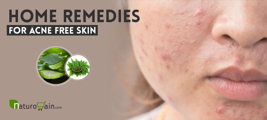 Home Remedies for Acne Free Skin