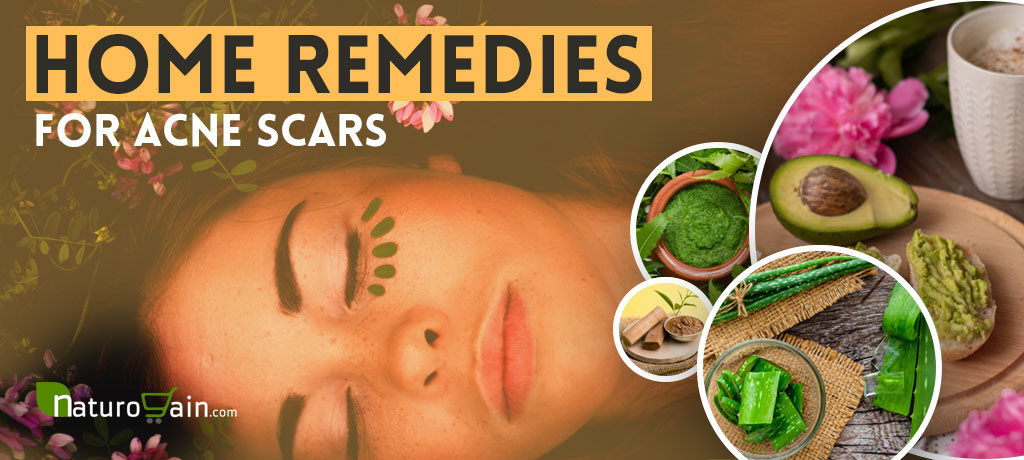 Best Home Remedies for Acne Scars