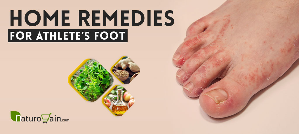 Home Remedies for Athlete's Foot