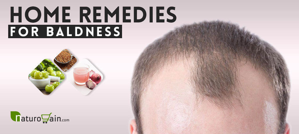 Home Remedies for Baldness