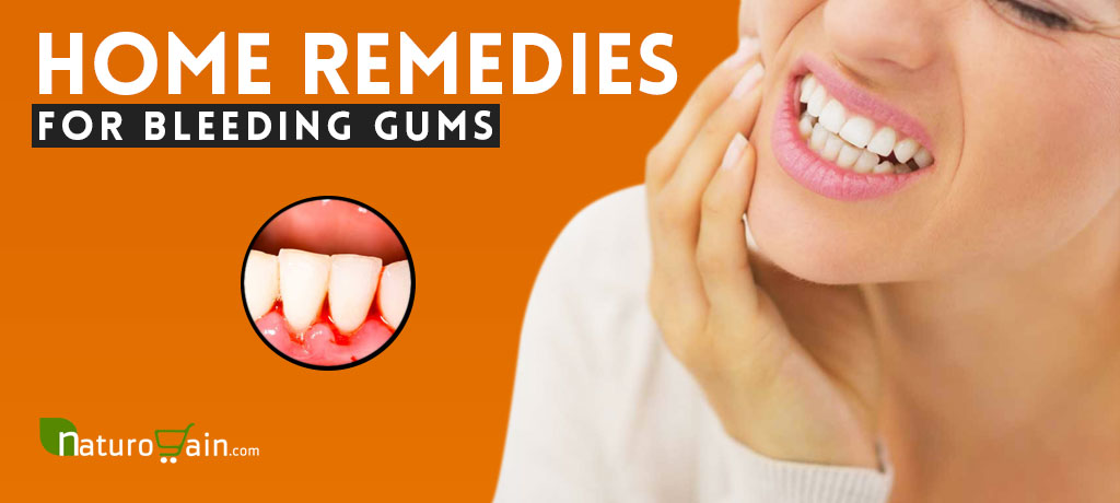 Home Remedies for Bleeding Gums