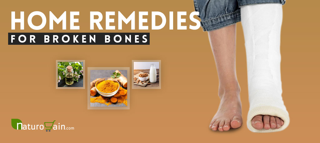 Home Remedies for Broken Bones