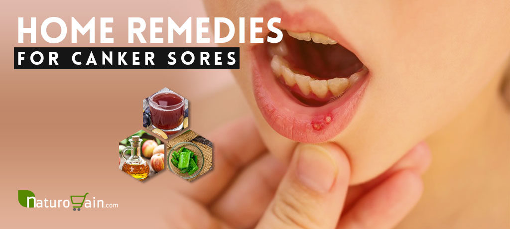 Home Remedies for Canker Sores