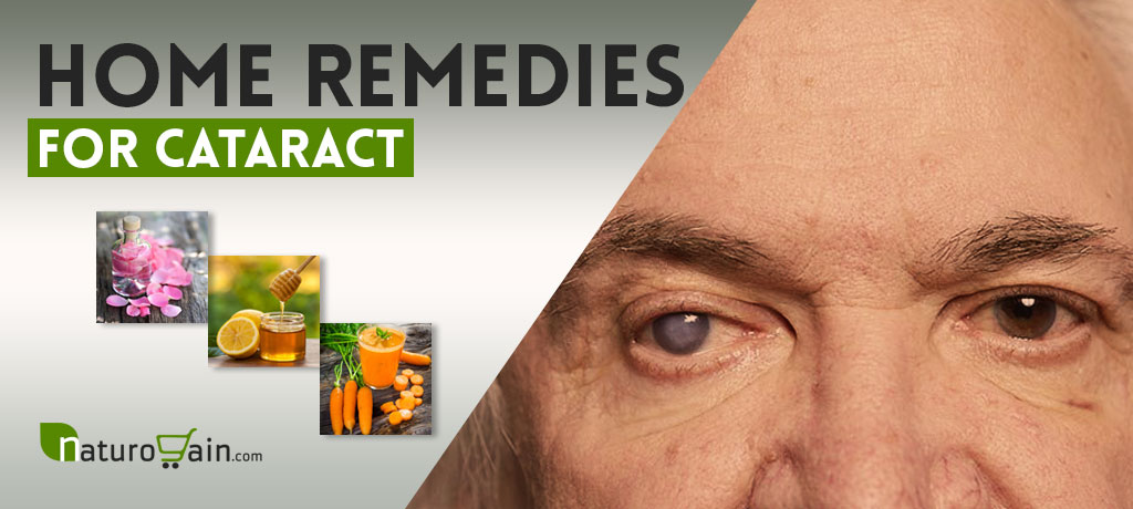 Home Remedies for Cataract