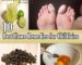 Home Remedies for Chilblains