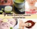 Best Home Remedies for Conjunctivitis