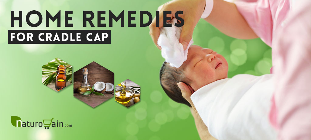 Home Remedies for Cradle Cap