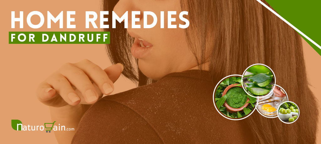 Home Remedies for Dandruff