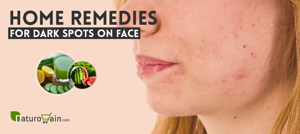 Home Remedies for Dark Spots on Face