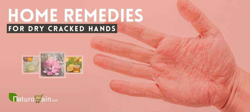 Home Remedies for Dry Cracked Hands