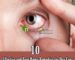 Home Remedies for Dry Eyes