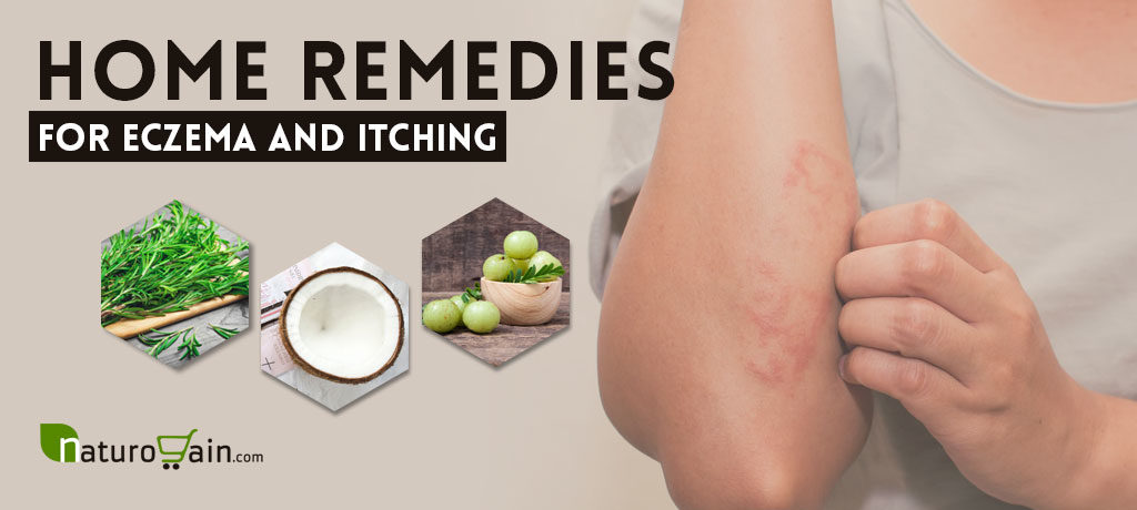 Home Remedies for Eczema