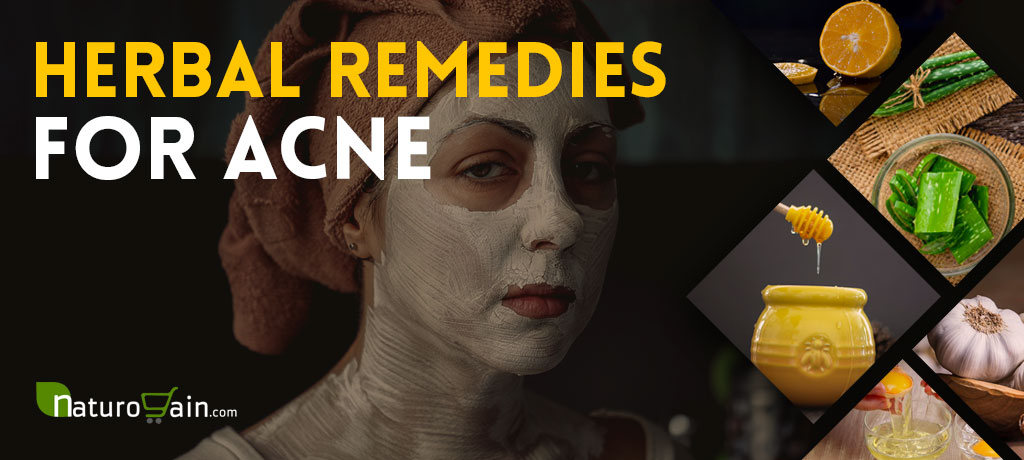 Herbal Remedies for Acne