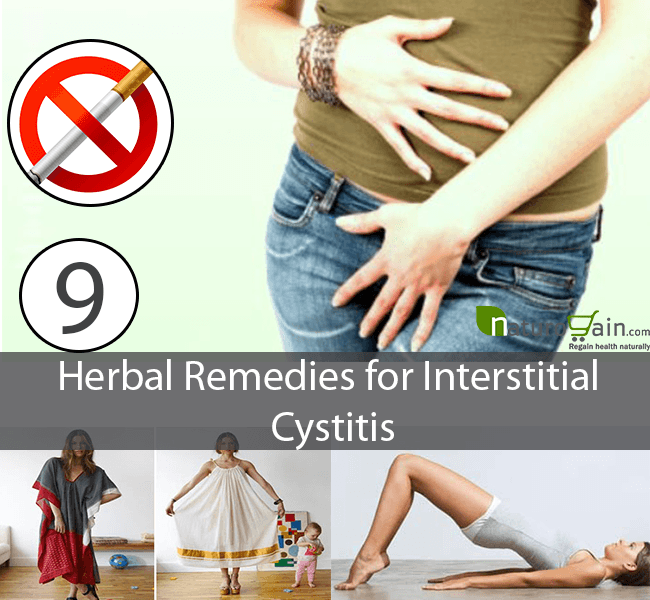 9 Powerful Herbal Remedies for Interstitial Cystitis Treat Painful