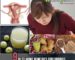 Home Remedies for Fibroids