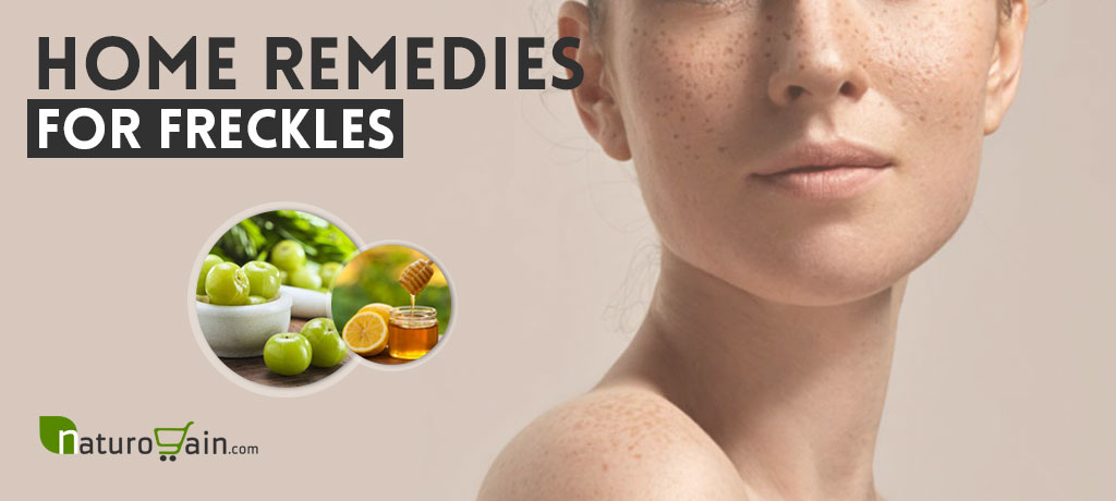 Home Remedies for Freckles