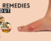 Home Remedies for Gout