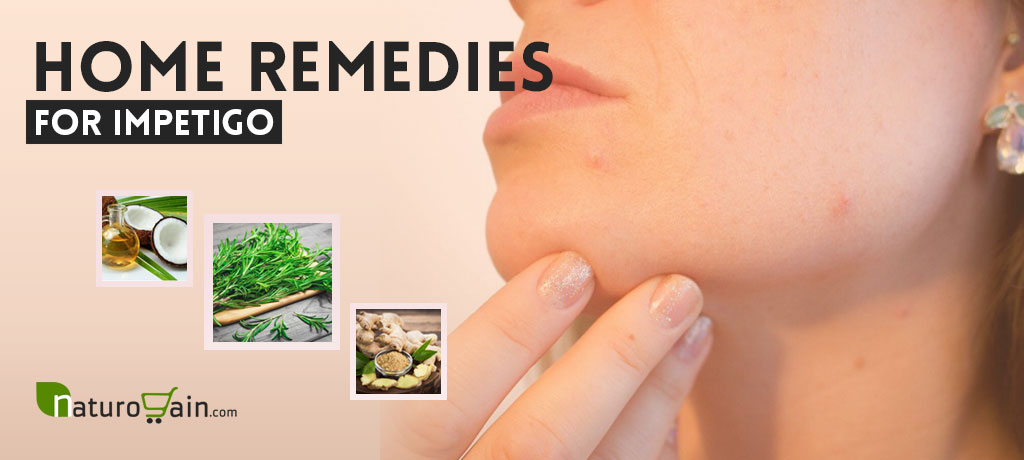 Home Remedies for Impetigo