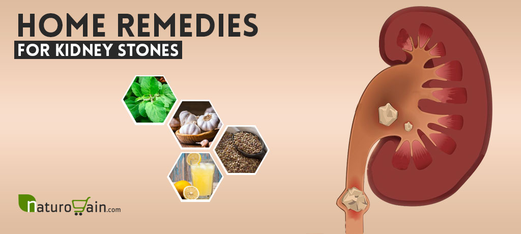 Home Remedies for Kidney Stones