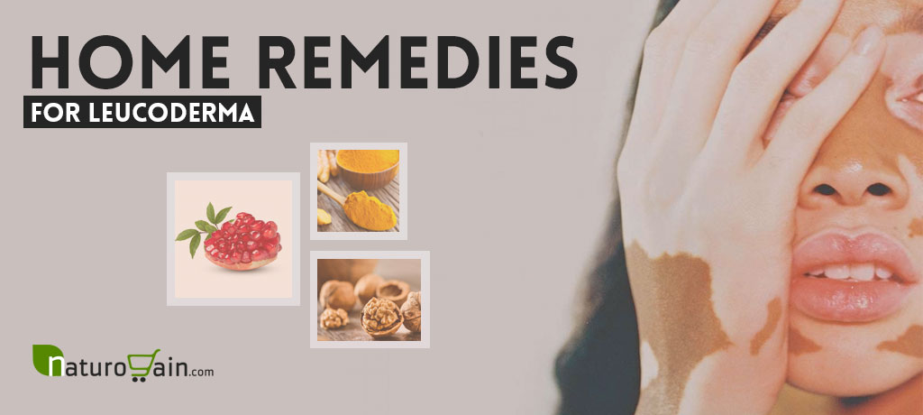 Home Remedies for Leucoderma