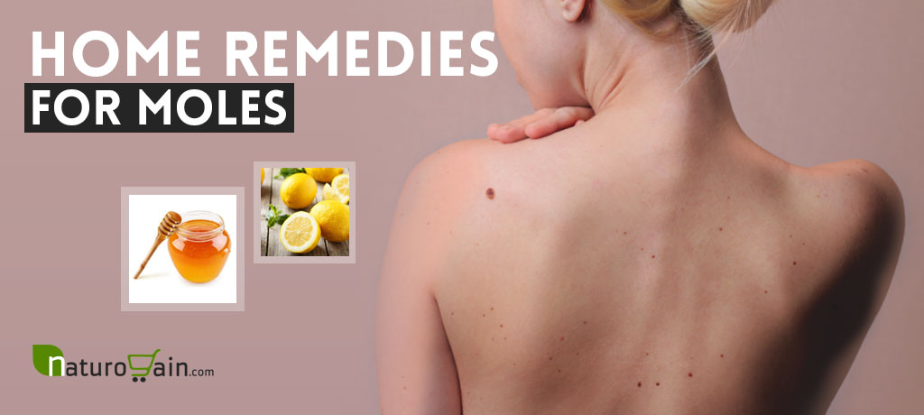 Home Remedies for Moles