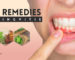 Home Remedies for Gingivitis