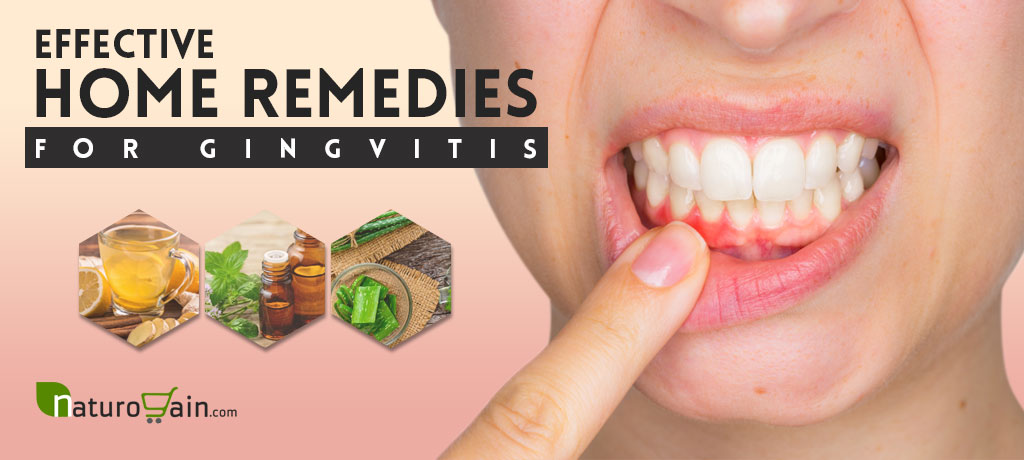 Home Remedies for Gingivitis