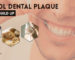 Control Dental Plaque And Tartar Buildup