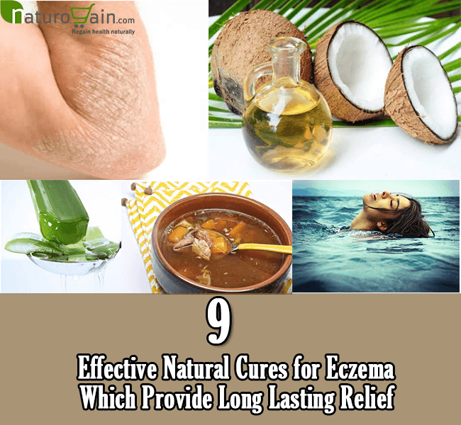9 Effective Natural Cures for Eczema Which Provide Long Lasting Relief