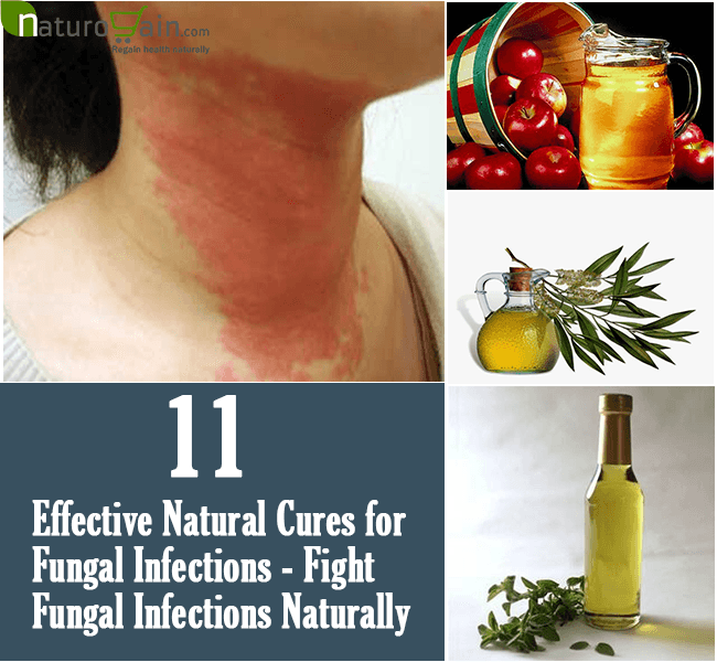 11 Effective Natural Cures for Fungal Infections Fight Fungal