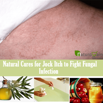Best Natural Cures For Jock Itch Best Natural Cures For Jock Itch