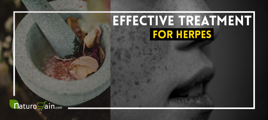 Natural Treatment for Herpes