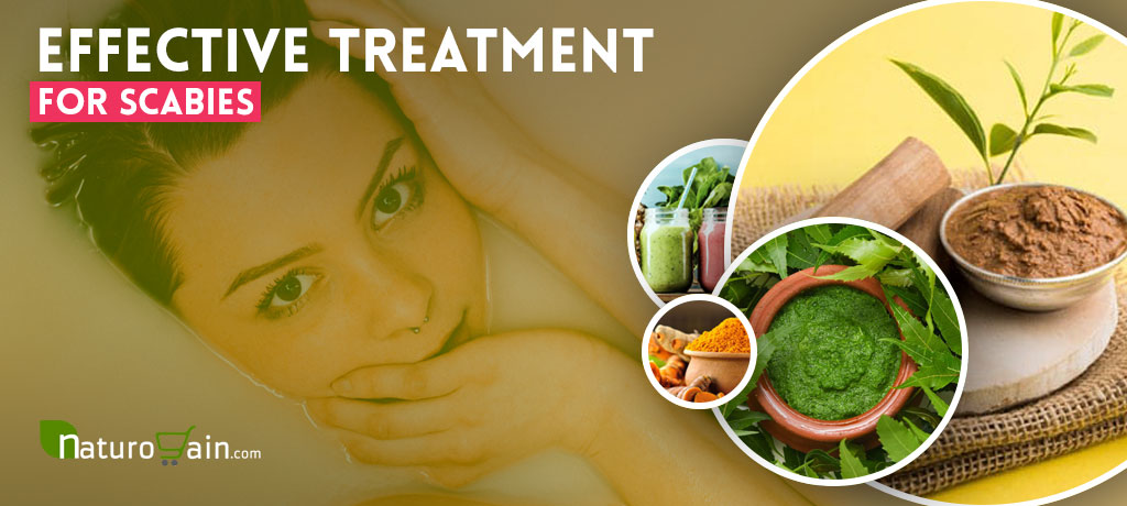 Natural Treatment for Scabies