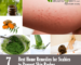 Home Remedies for Scabies