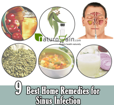 Home Remedies for Sinus Infection