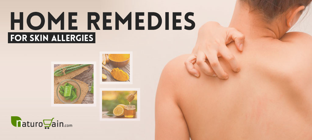 Home Remedies for Skin Allergies