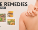 Home Remedies for Skin Allergies