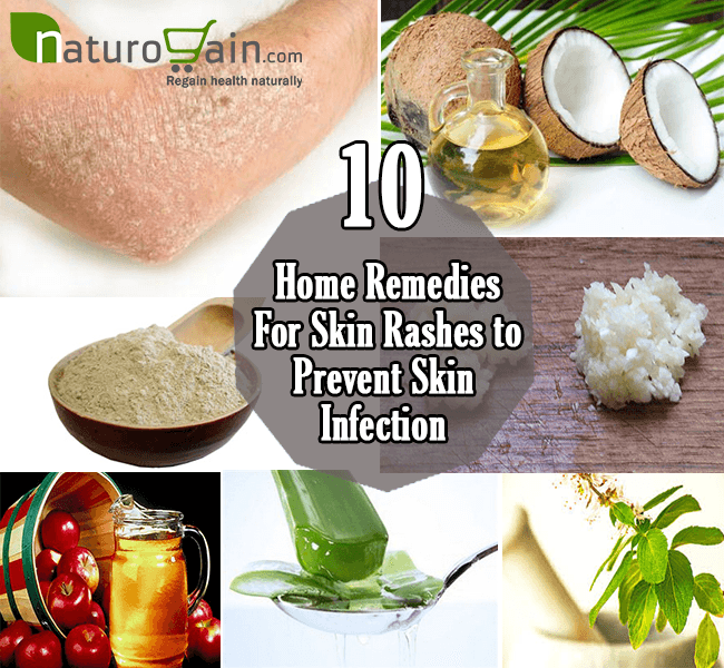 Skin Rash Home Remedies