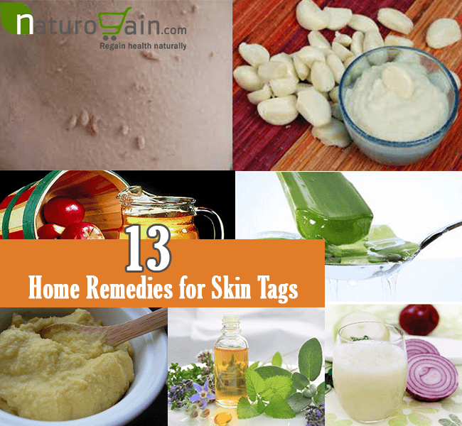 best skin care home remedies