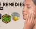 Home Remedies to Tame Oily Skin