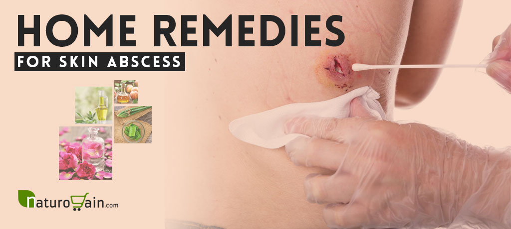 Home Remedies for Skin Abscess