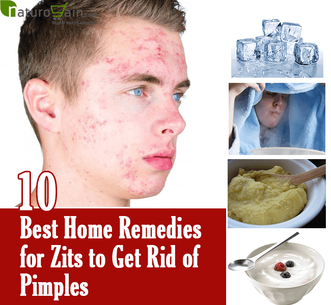 10 Best Home Remedies for Zits to Get Rid of Pimples