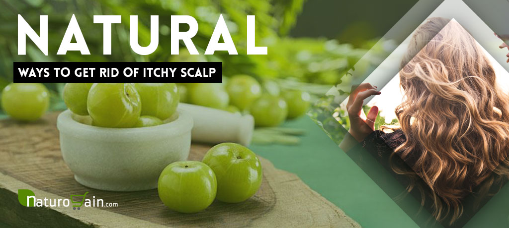 Natural Ways to Get Rid of Itchy Scalp