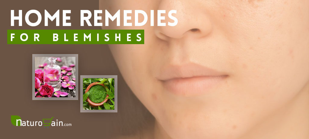 Home Remedies for Blemishes