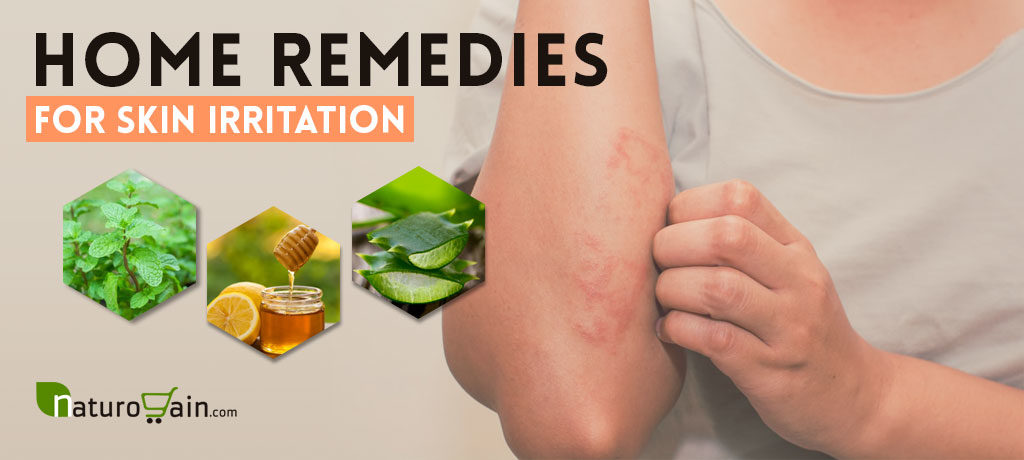 Home Remedies for Skin Irritation