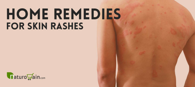 different skin rashes that itch