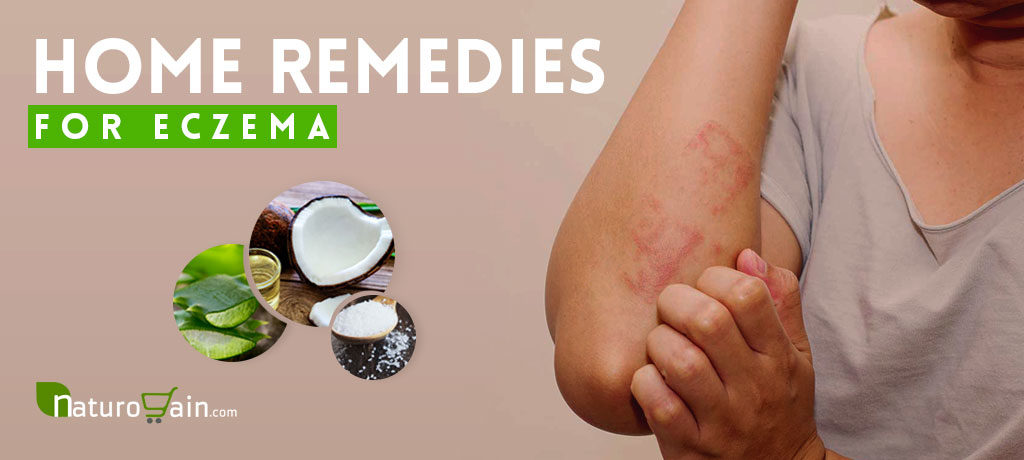 Home Remedies for Eczema