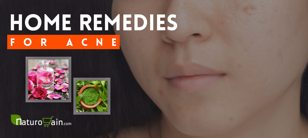 Home Remedies for Acne Skin Problem